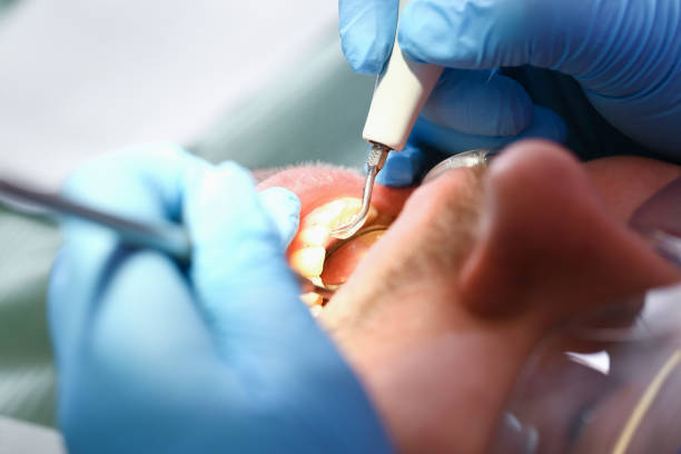 Best Chipped Tooth Repair Near Me  in Cedarburg, WI